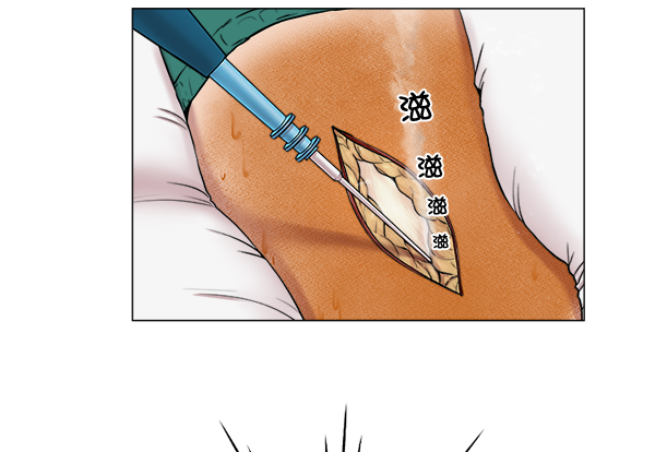 [第21话] 颅骨骨折0