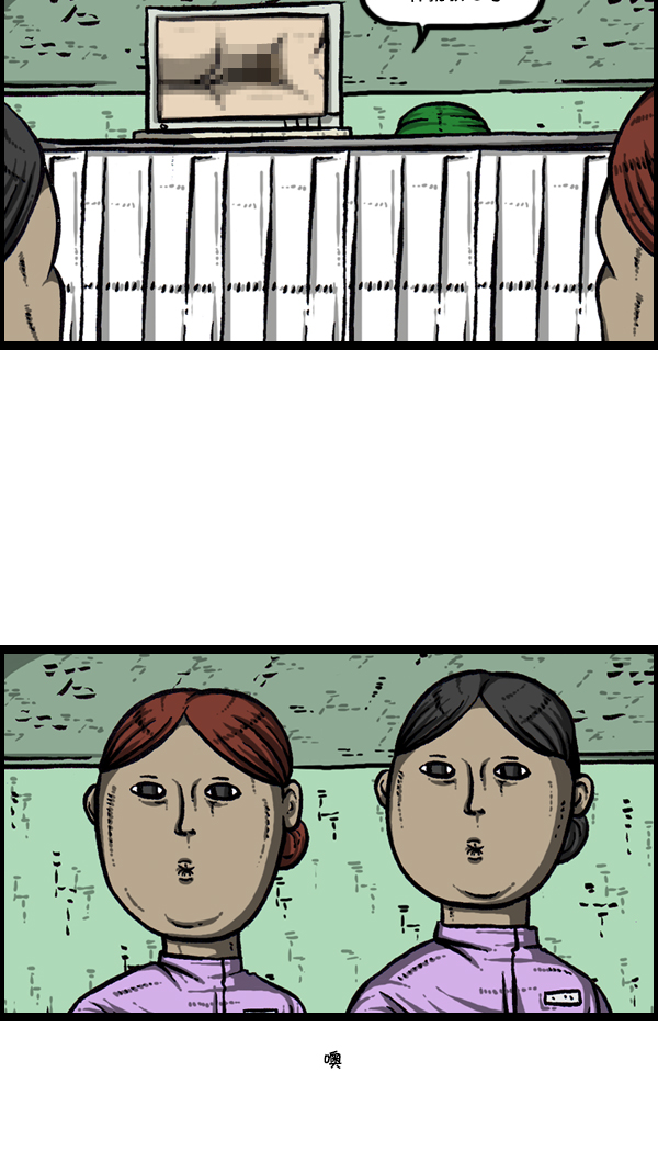 [第300话] 大肠内视镜检查4